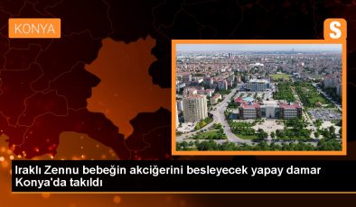 Irak’ta doğan bebeğe Konya’da yapay damar yerleştirildi