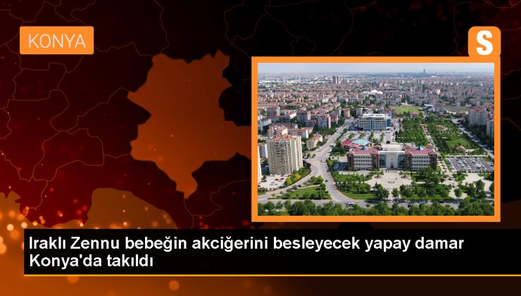 Irak’ta doğan bebeğe Konya’da yapay damar yerleştirildi